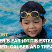 Swimmer's Ear Blog Post Rectangle