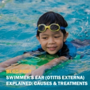 Swimmers Ear Otitis Externa Explained Causes and Treatments in Ansonia CT Blog Post Square
