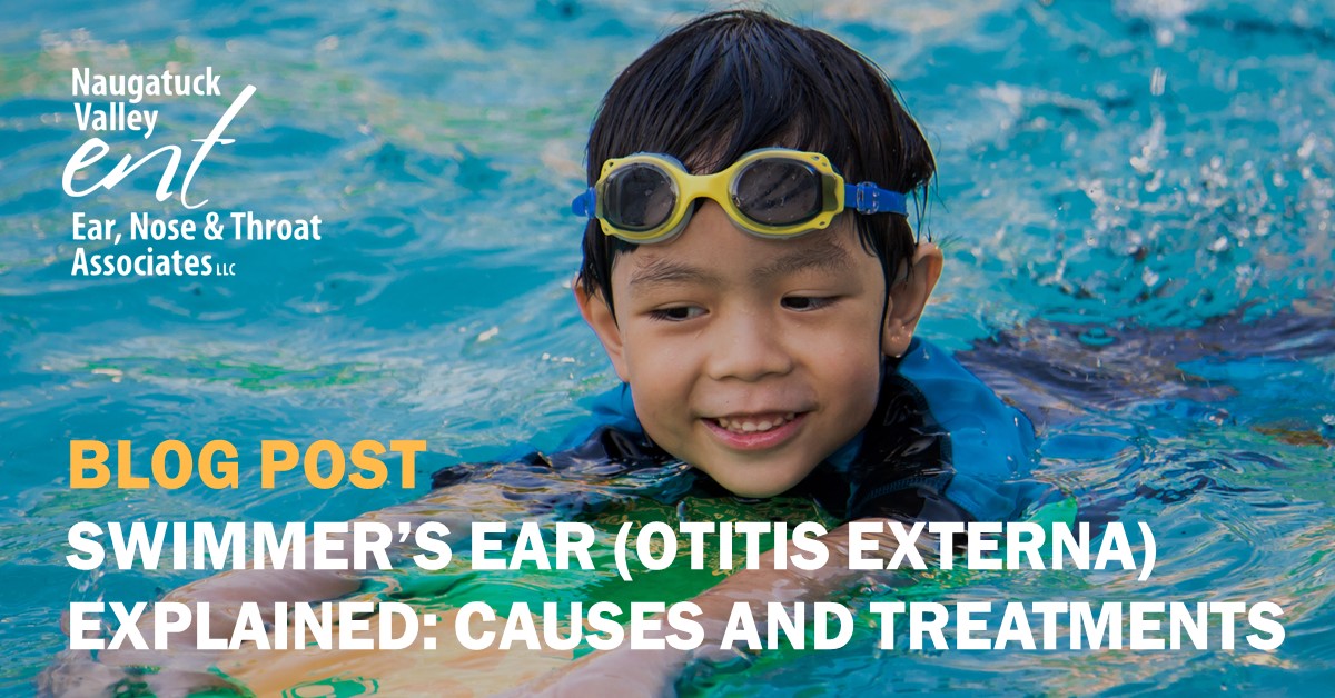 Swimmer’s Ear (Otitis Externa) Explained: Causes And Treatments In ...