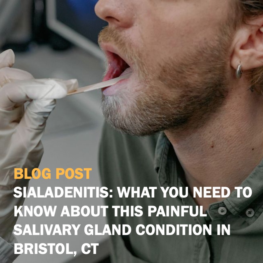 SIALADENITIS- WHAT YOU NEED TO KNOW ABOUT THIS PAINFUL SALIVARY GLAND CONDITION IN BRISTOL, CT SQUARE NO LOGO