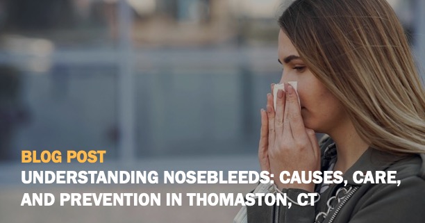 Understanding Nosebleeds Blog Post Rectangle